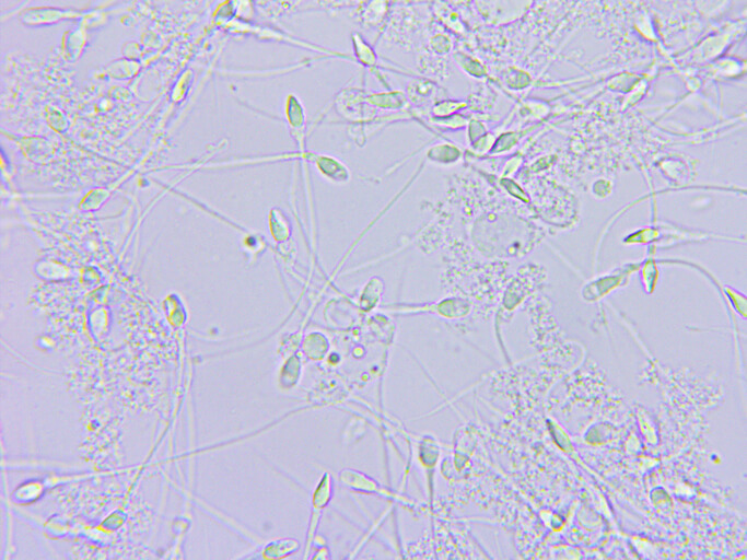 Sperm microscopic view