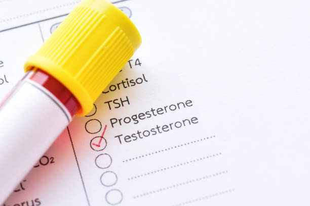 Blood sample tube for testosterone hormone test